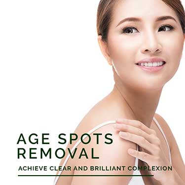 Age Spots Removal Treatment